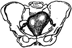 Ознака Піскачека - зовнішнє випинання  правого кута матки, якщо термін вагітності близько 12 тижнів