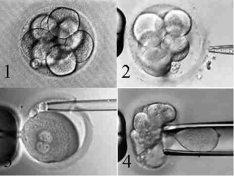 Методи мікроманіпуляції на ембріоні людини